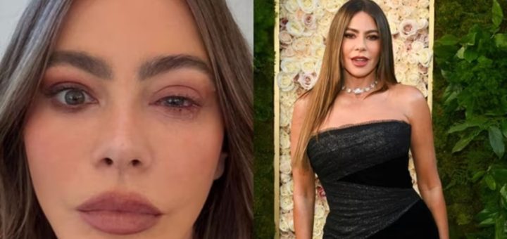 Sofia Vergara skipped the 2025 Emmys due to eye allergy