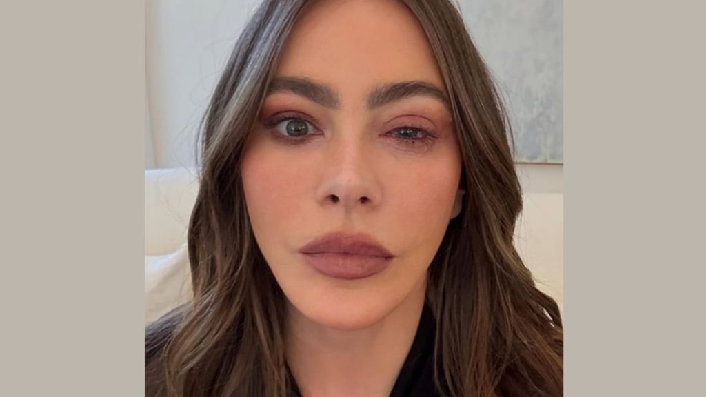 Sofia Vergara eye allergy condition