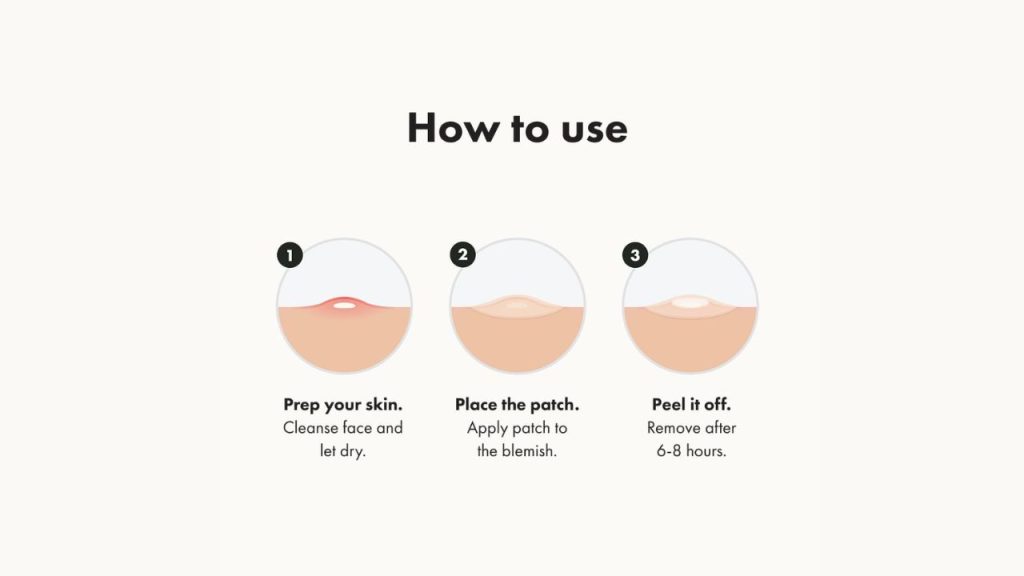 Before and after using Mighty Patch: red, swollen pimple becomes flat and less red overnight.